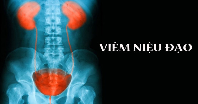 Dương Vật Chảy Mủ Là Biểu Hiện Của Viêm Niệu Đạo