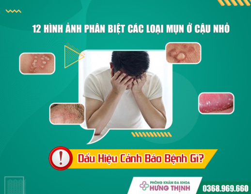 12 Hình Ảnh Phân Biệt Các Loại Mụn Ở Cậu Nhỏ, Dấu Hiệu Cảnh Báo Bệnh Gì?