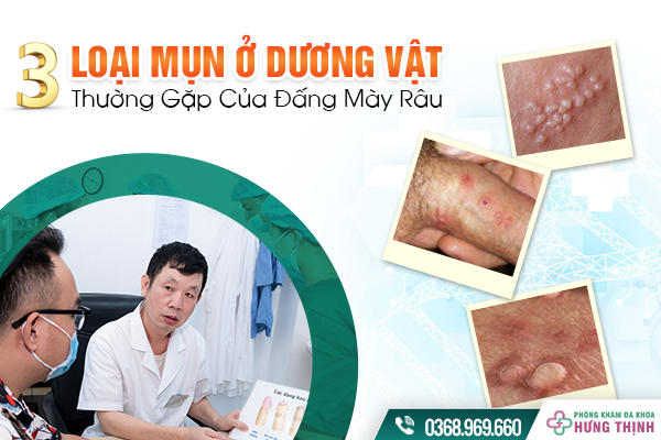 3 Loại Mụn Ở Dương Vật Thường Gặp Của Đấng Mày Râu