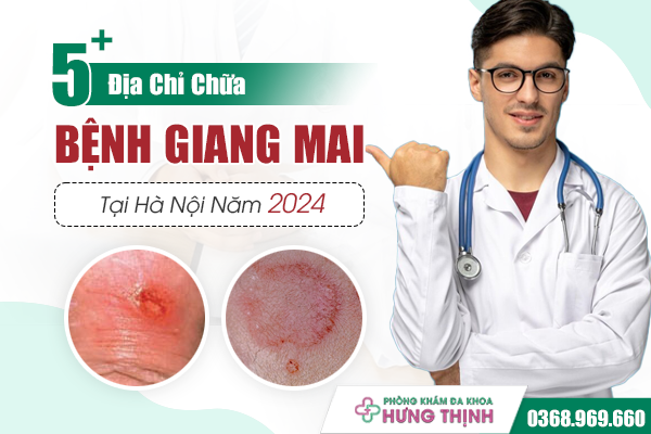 5+ Địa Chỉ Chữa Giang Mai Uy Tín, Hiệu Quả Tại Hà Nội Năm 2024