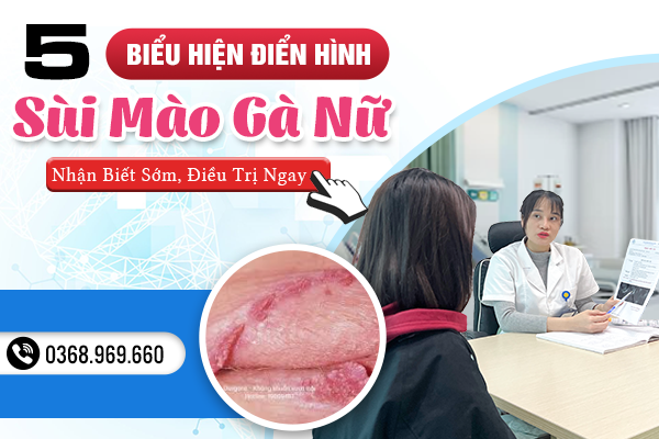 5 Biểu Hiện Sùi Mào Gà Nữ Điển Hình -  Nhận Biết Sớm, Điều Trị Ngay