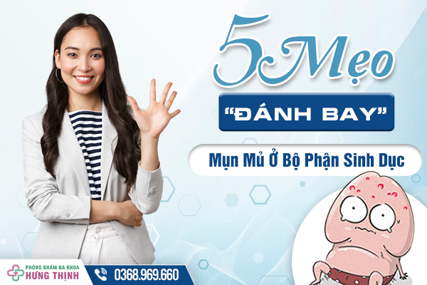  5 Mẹo Cực Đơn Giản “Đánh Bay” Mụn Mủ Ở Bộ Phận Sinh Dục 