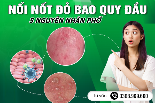 5 Nguyên Nhân Phổ Biến Gây Nổi Nốt Đỏ Ở Bao Quy Đầu