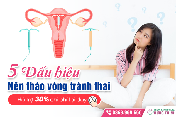 Muốn Đặt Vòng Tránh Thai - Chị Em Đừng Bỏ Qua Những Thông Tin Này