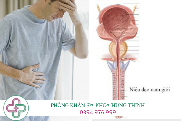 Triệu chứng viêm niệu đạo ở nam giới