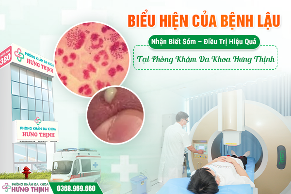 Biểu Hiện Của Bệnh Lậu: Nhận Biết Sớm – Điều Trị Hiệu Quả Tại Phòng Khám Đa Khoa Hưng Thịnh