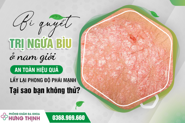 Bí quyết trị ngứa bìu ở nam giới an toàn hiệu quả - lấy lại phong độ phái mạnh. Tại sao bạn không thử?