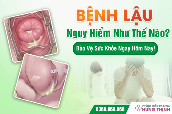 Bệnh Lậu Nguy Hiểm Như Thế Nào? Bảo Vệ Sức Khỏe Ngay Hôm Nay!