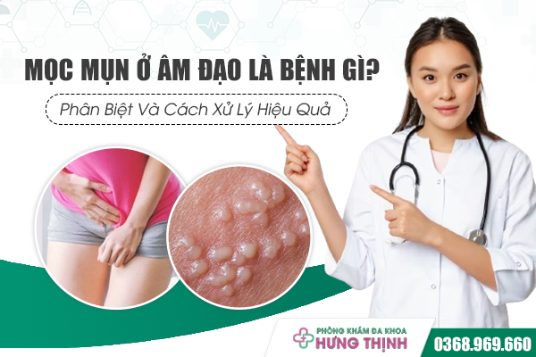 Bị Mọc Mụn Ở Âm Đạo Là Mắc Bệnh Gì? Phân Biệt Và Cách Xử Lý Hiệu Quả