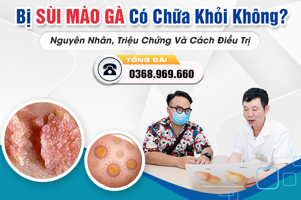 Bị Sùi Mào Gà Có Chữa Khỏi Được Không? Nguyên Nhân, Triệu Chứng Và Cách Điều Trị