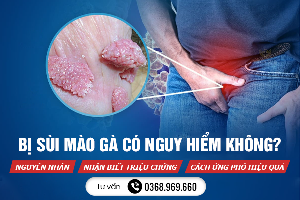 Bị Sùi Mào Gà Có Nguy Hiểm Không? Nguyên Nhân, Nhận Biết Triệu Chứng Và Cách Ứng Phó Hiệu Quả