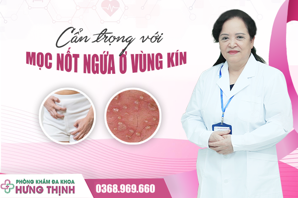 Cẩn Trọng Tiềm Ẩn Nguy Cơ Đằng Sau Tình Trạng Mọc Nốt Ngứa Ở Vùng Kín