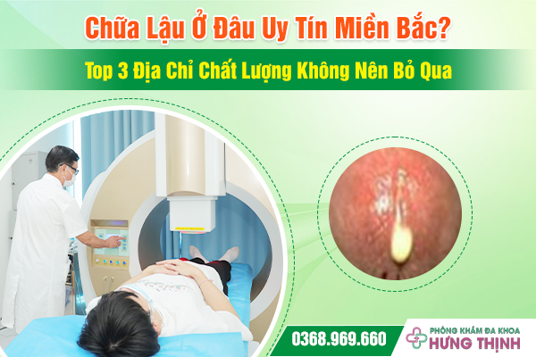 Chữa Lậu Ở Đâu Uy Tín Miền Bắc? Top 3 Địa Chỉ Chất Lượng Không Nên Bỏ Qua