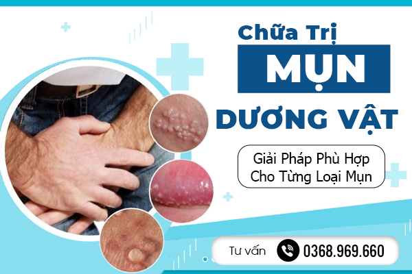 Chữa Trị Mụn Dương Vật - Giải Pháp Phù Hợp Cho Từng Loại Mụn