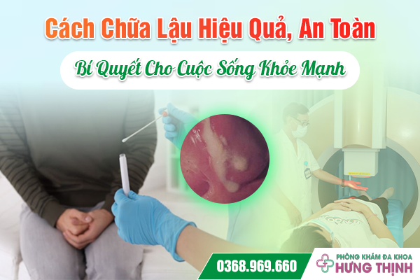 Cách Chữa Lậu Hiệu Quả, An Toàn - Bí Quyết Cho Cuộc Sống Khỏe Mạnh