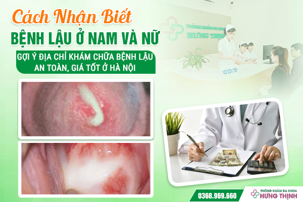 Cách Nhận Biết Bệnh Lậu Ở Nam Và Nữ - Gợi Ý Địa Chỉ Khám Chữa Bệnh Lậu An Toàn, Giá Tốt Ở Hà Nội