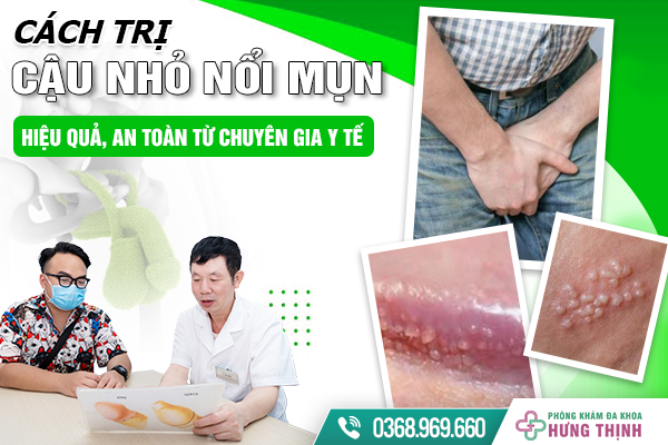 Cách Trị Cậu Nhỏ Nổi Mụn Hiệu Quả, An Toàn Từ Chuyên Gia Y Tế