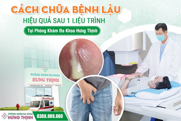 Cách chữa bệnh lậu hiệu quả sau 1 liệu trình tại Phòng khám Đa khoa Hưng Thịnh