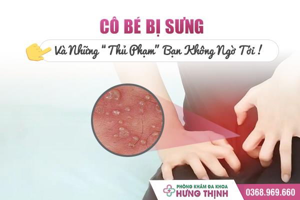 Cô bé bị ngứa sau khi quan hệ: Đi tìm nguyên nhân và cách điều trị hiệu quả