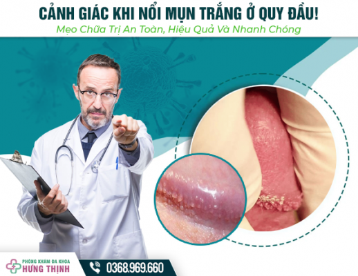 Cảnh Giác Khi Nổi Mụn Trắng Ở Quy Đầu! Mẹo Chữa Trị An Toàn, Hiệu Quả Và Nhanh Chóng