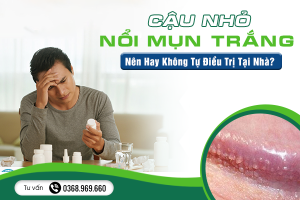 Cậu Nhỏ Nổi Mụn Trắng: Nên Hay Không Tự Điều Trị Tại Nhà?