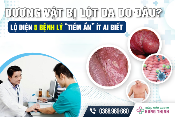 Dương Vật Bị Lột Da Do Đâu? Lộ Diện 5 Bệnh Lý “Tiềm Ẩn” Ít Ai Biết