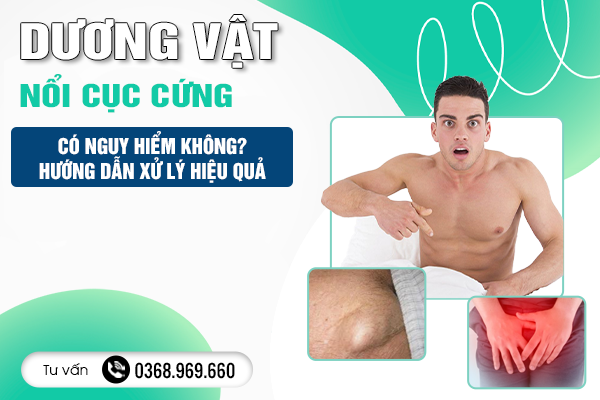 Dương Vật Nổi Cục Cứng Có Nguy Hiểm Không? Hướng Dẫn Xử Lý Hiệu Quả