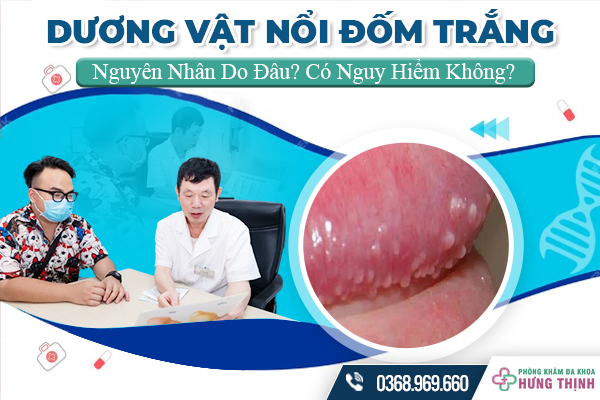 Dương Vật Nổi Đốm Trắng Nguyên Nhân Do Đâu? Có Nguy Hiểm Không?