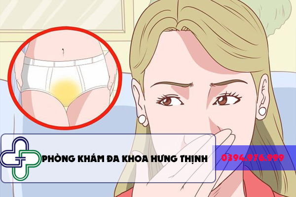 Khí hư màu vàng – Nguyên nhân, triệu chứng và cách điều trị