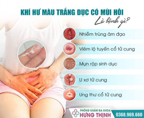 Vùng Kín Ra Nhiều Khí Hư Màu Trắng Đục Báo Hiệu Vấn Đề Gì Ở Nữ Giới?