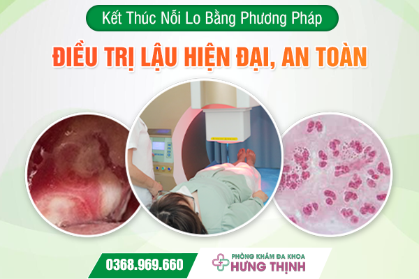 Kết Thúc Nỗi Lo Bằng Phương Pháp Điều Trị Lậu Hiện Đại, An Toàn