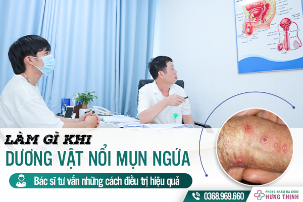 Làm gì khi dương vật nổi mụn trắng ngứa? Bác sĩ tư vấn những cách điều trị hiệu quả 