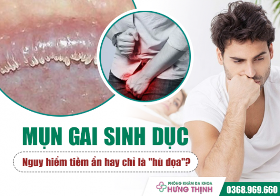 Mụn gai sinh dục: Nguy hiểm tiềm ẩn hay chỉ là 