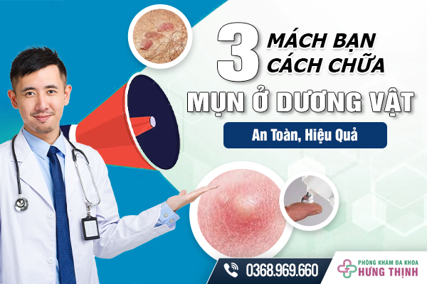 Mách Bạn 3 Cách Chữa Mụn Ở Dương Vật An Toàn, Hiệu Quả