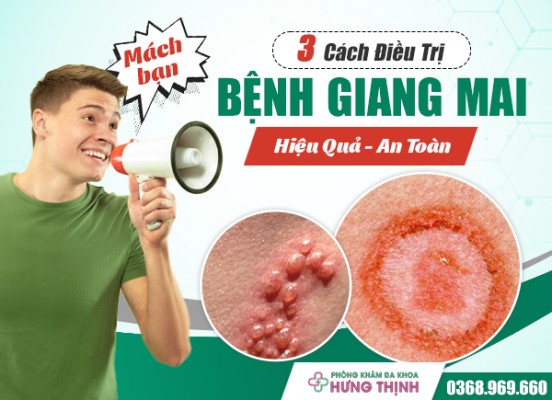 Mách Bạn 3 Cách Điều Trị Bệnh Giang Mai Hiệu Quả, An Toàn