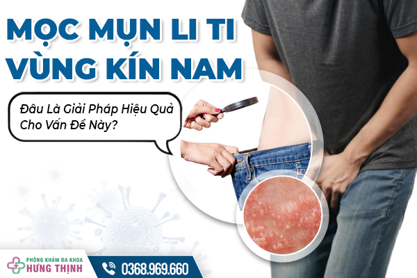  Mọc Mụn Li Ti Vùng Kín Nam Là Bệnh Gì? Đâu Là Giải Pháp Hiệu Quả Cho Vấn Đề Này?