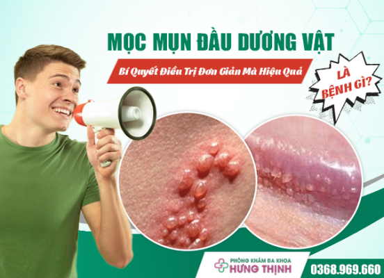 Mọc Mụn Đầu Dương Vật Là Bệnh Gì? Bí Quyết Điều Trị Đơn Giản Mà Hiệu Quả