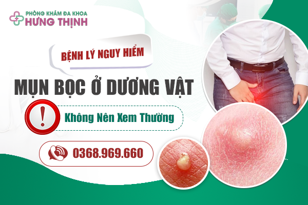  Mụn Bọc Ở Dương Vật - Dấu Hiệu Bệnh Lý “Nguy Hiểm” Không Nên Xem Thường