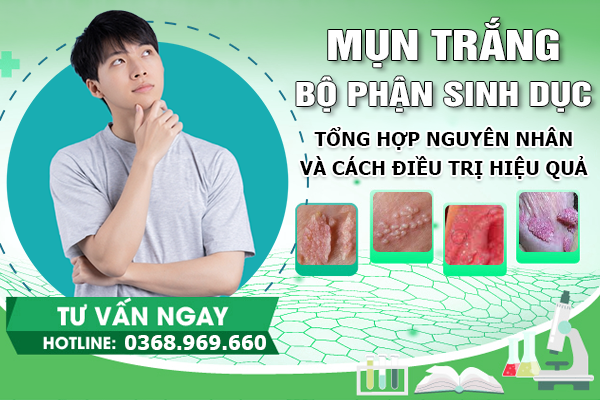 Mụn Trắng Ở Bộ Phận Sinh Dục: Tổng Hợp Nguyên Nhân Và Cách Điều Trị Hiệu Quả