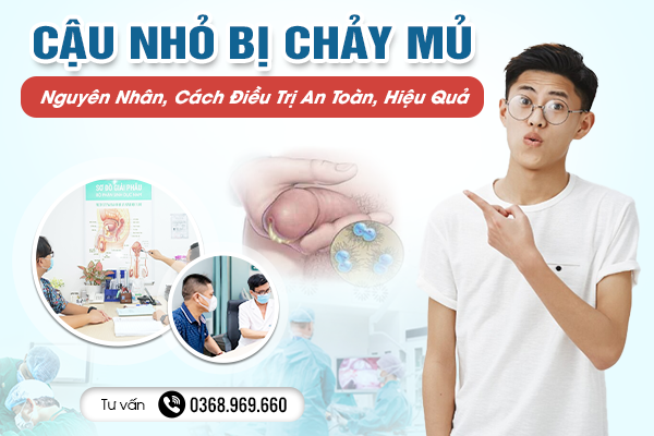 Nguyên Nhân Cậu Nhỏ Bị Chảy Mủ, Cách Điều Trị An Toàn, Hiệu Quả Bạn Không Nên Bỏ Qua