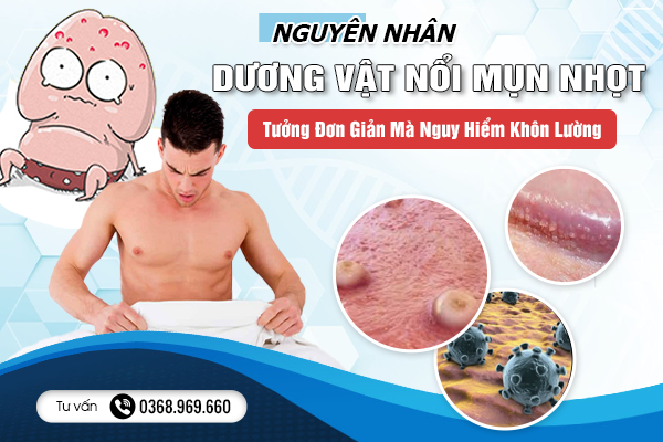 Nguyên Nhân Dương Vật Nổi Mụn Nhọt - Tưởng Đơn Giản Mà Nguy Hiểm Khôn Lường