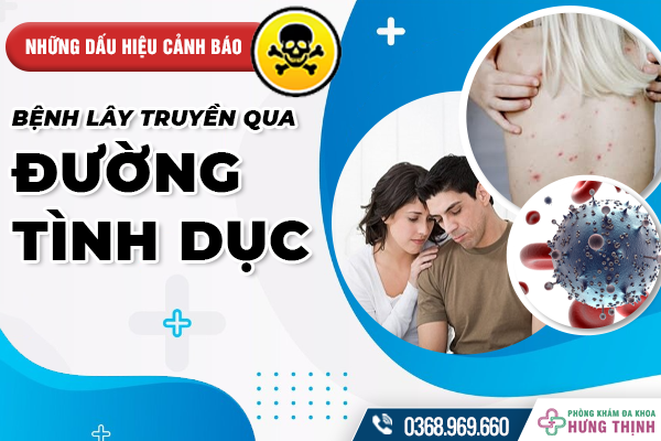 Những dấu hiệu cảnh báo bạn có thể mắc bệnh lây truyền qua đường tình dục