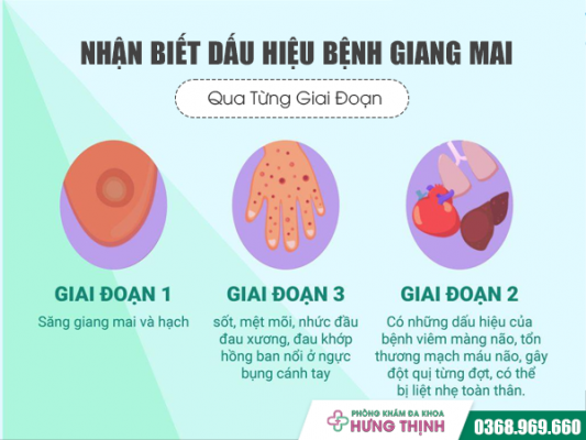 Nhận Biết Dấu Hiệu Bệnh Giang Mai Qua Từng Giai Đoạn