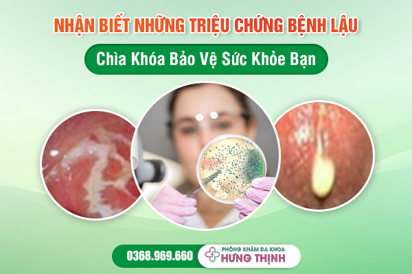 Nhận Biết Những Triệu Chứng Bệnh Lậu - Chìa Khóa Bảo Vệ Sức Khỏe Bạn