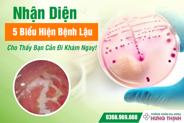 Nhận Diện 5 Biểu Hiện Bệnh Lậu Cho Thấy Bạn Cần Đi Khám Ngay!