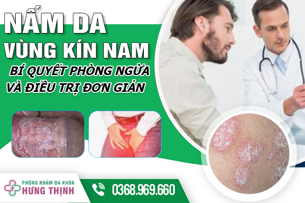 Nấm Da Vùng Kín Nam Giới Là Gì? Bí Quyết Phòng Ngừa Và Điều Trị Đơn Giản