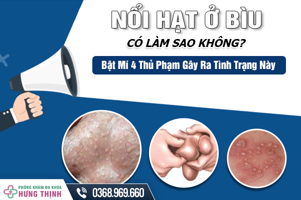 Nổi Hạt Ở Bìu Có Làm Sao Không? Bật Mí 4 Thủ Phạm Gây Ra Tình Trạng Này