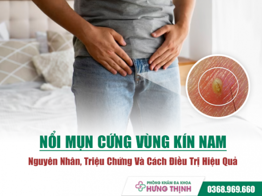 Nổi Mụn Cứng Vùng Kín Nam: Nguyên Nhân, Triệu Chứng Và Cách Điều Trị Hiệu Quả