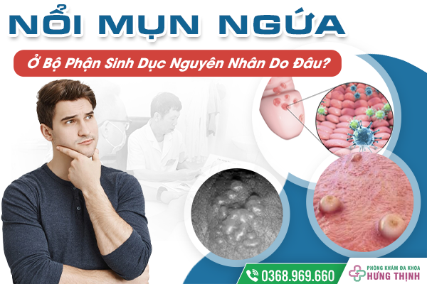 Nổi Mụn Ngứa Ở Bộ Phận Sinh Dục Nguyên Nhân Do Đâu? Vấn Đề Nhạy Cảm Không Thể Coi Thường