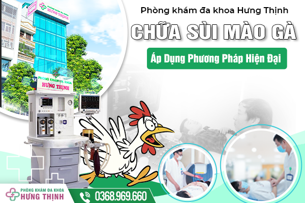 Phòng Khám Đa Khoa Hưng Thịnh - Địa Chỉ Uy Tín Áp Dụng Phương Pháp Hiện Đại Chữa Bệnh Sùi Mào Gà